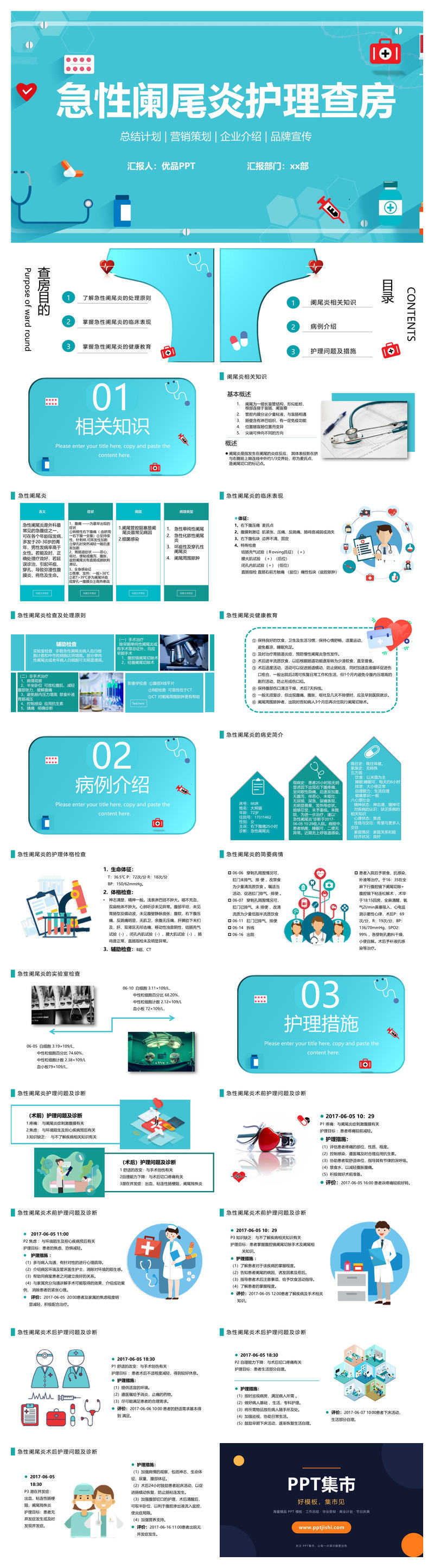 急性阑尾炎护理查房治疗PPT模板